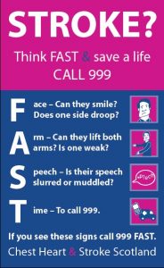 tia stroke symptoms attack transient ischaemic scotland