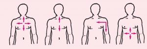 Angina is a type of chest pain that happens when the blood supply to the heart becomes restricted