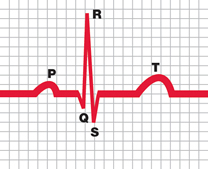 An ECG gives a recording of the electrical activity of your heart