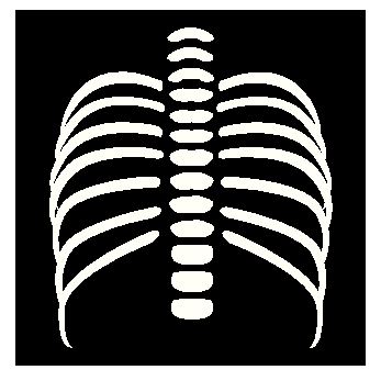 Xray